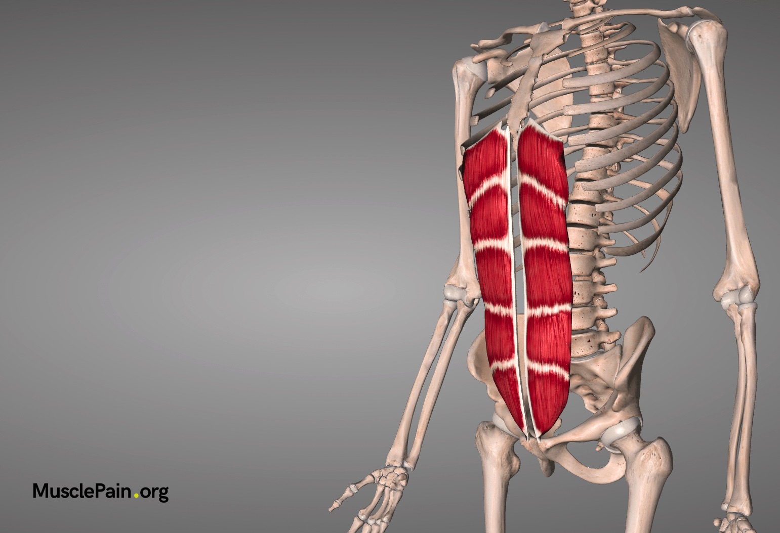 Rectus Abdominus Muscle Pain - Muscle Pain