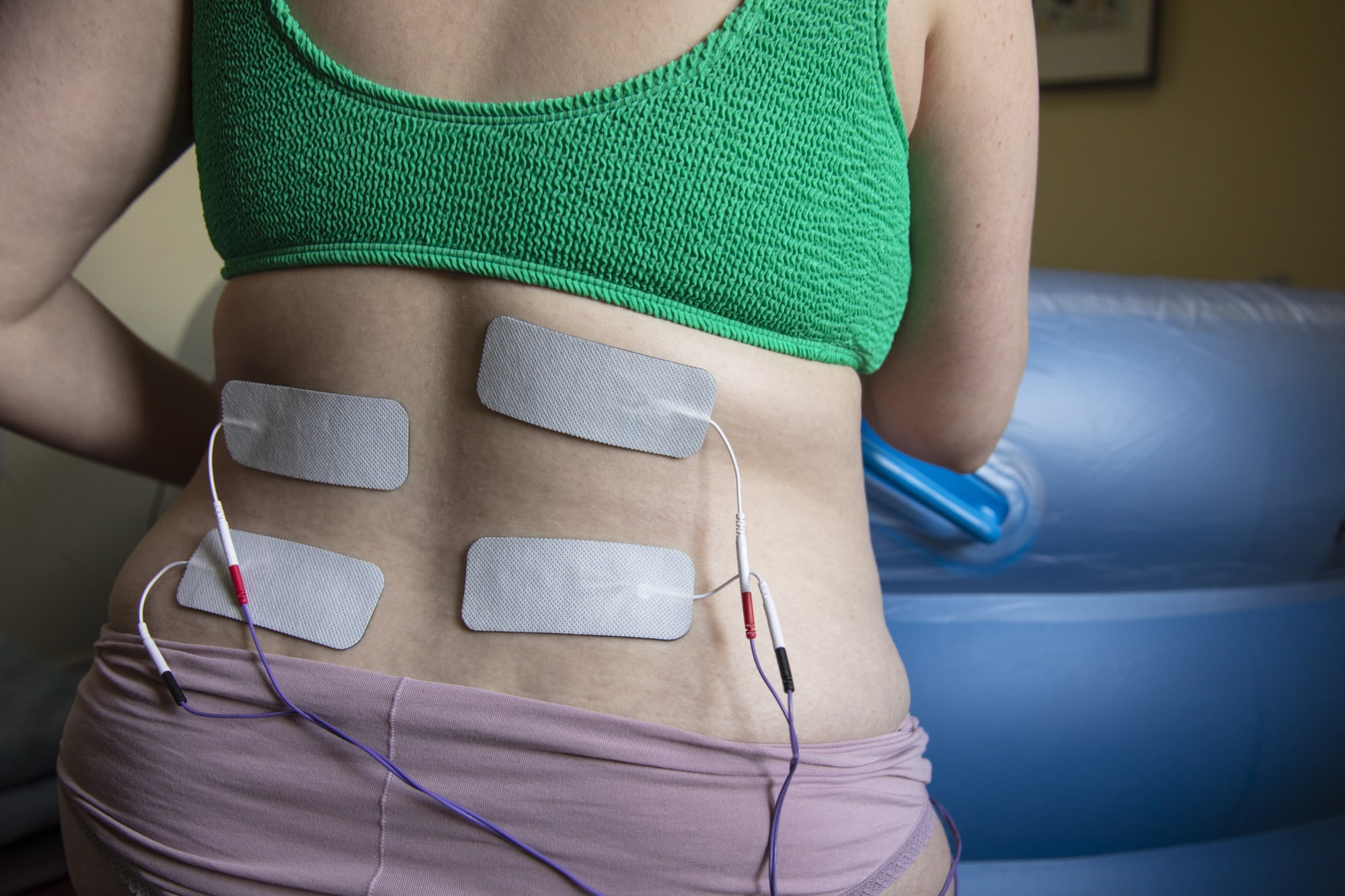 How to Use a TENS Unit With Low Back Pain. Correct Pad Placement 